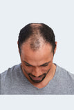 Man with thinning hair before wearing the Jean mens hair piece from Fascinations 